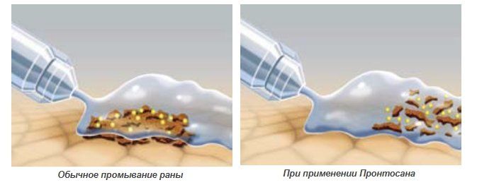 Пронтосан.jpg Пронтосан.jpg